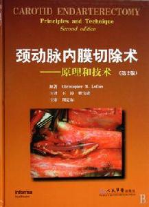 頸動脈內膜切除術 頸動脈內膜切除術