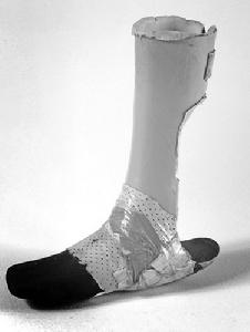 克羅埃西亞首都薩格勒布“心碎博物館”展品：一位退伍軍人的義肢，他曾與自己的復健師相戀。