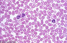 血塗片染色 血塗片染色