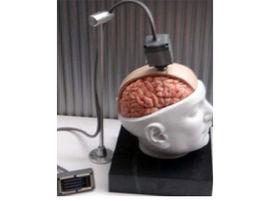 枕葉癲癇 枕葉癲癇