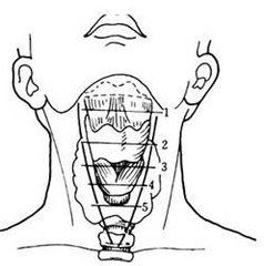 咽部及頸部食管閉合性損傷