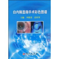 白內障顯微手術彩色圖譜