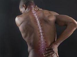 腰背部竇道 腰背部竇道