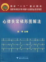 心律失常梯型圖解法