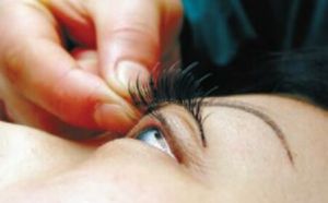 單純皰疹性角膜炎