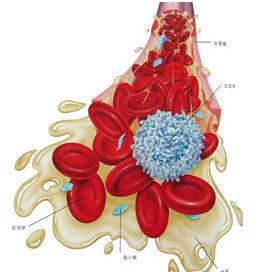 真性紅細胞增多症