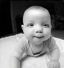 兒童混合型腦癱 兒童混合型腦癱