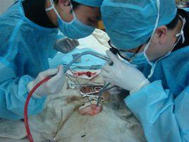 鼻內窺鏡篩竇切除術 鼻內窺鏡篩竇切除術