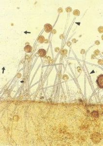 黃麴黴菌 黃麴黴菌