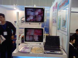 口腔內窺鏡系統 口腔內窺鏡系統