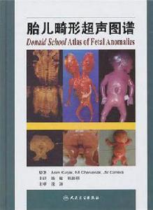 胎兒畸形超聲圖譜 胎兒畸形超聲圖譜
