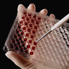 血清總膽固醇 血清總膽固醇