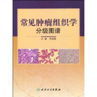 常見腫瘤組織學分級圖譜 常見腫瘤組織學分級圖譜