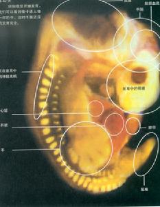 （圖）神經皮膚綜合徵