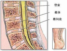 腰間盤 腰間盤