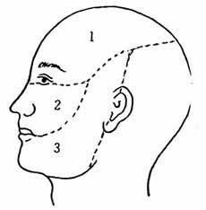 原發性三叉神經痛 原發性三叉神經痛