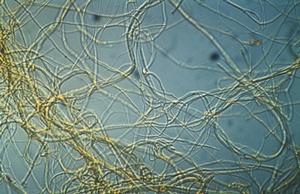 坎培波爾特青黴菌 坎培波爾特青黴菌