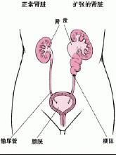 慢性腎病 慢性腎病