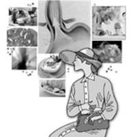 反流性食道炎 反流性食道炎