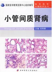 特發性急性小管間質性腎炎