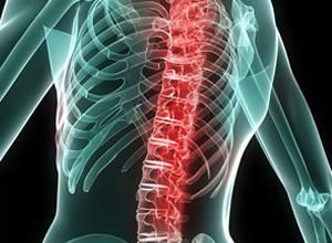 胸椎疼痛 胸椎疼痛