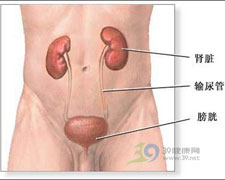 腎結核對側腎積水