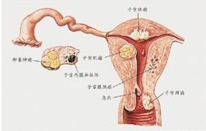 宮外孕現象
