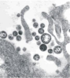 （圖）拉沙熱病毒
