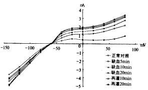 心室晚電位檢查