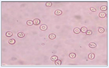 正常紅細胞形態