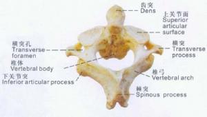 寰樞椎脫位 寰樞椎脫位