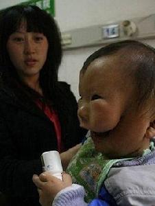 面具男孩[事件人物]