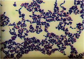 乳酸乳球菌 乳酸乳球菌