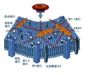 紅細胞膜缺陷 紅細胞膜缺陷