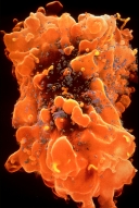 電子顯微鏡下的拉沙熱病毒
