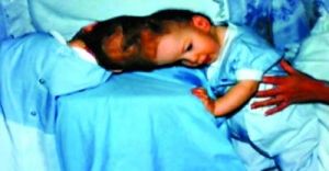 雖然出世前被預測存活率只有5%，但兄弟倆仍頑強活了下來