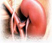 小兒過敏性紫癜性腎炎