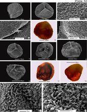 大孢子SEM和透射光對比照片