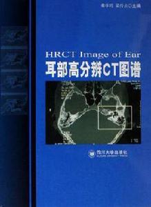 耳部高分辨CT圖譜 耳部高分辨CT圖譜