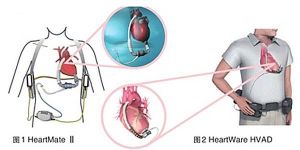 正性肌力 正性肌力