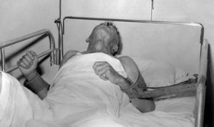 狂犬病患者 狂犬病患者