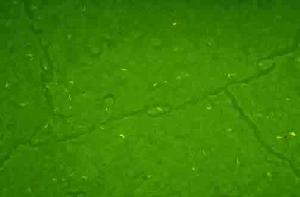 採用金胺染色法分支桿菌肺結核螢光顯微鏡圖像