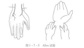 Allen試驗 Allen試驗