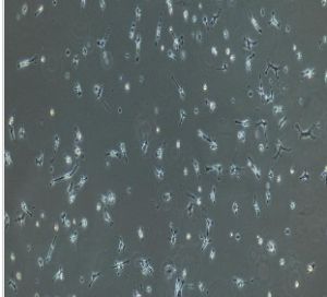 肺巨噬細胞