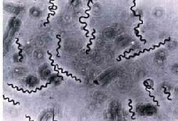 微白螺孢菌