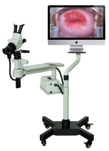 立體陰道鏡 立體陰道鏡