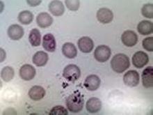 犬巴貝斯焦蟲病