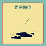 尿黑酸症 尿黑酸症