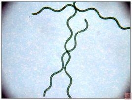 鈍頂螺旋藻 鈍頂螺旋藻