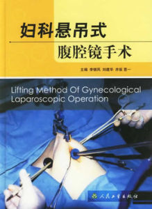 婦科懸吊式腹腔鏡手術 婦科懸吊式腹腔鏡手術